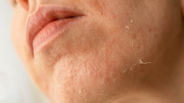 Szara i zmęczona cera? Dermatolodzy wskazują..